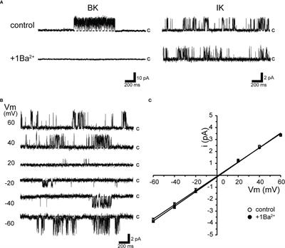 Intermediate conductance Ca2+-activated potassium channels are activated by functional coupling with stretch-activated nonselective cation channels in cricket myocytes